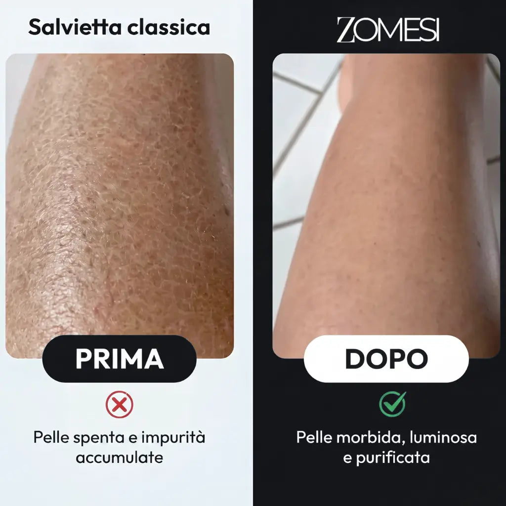 Eskano™ - Asciugamano da doccia esfoliante Zomesi