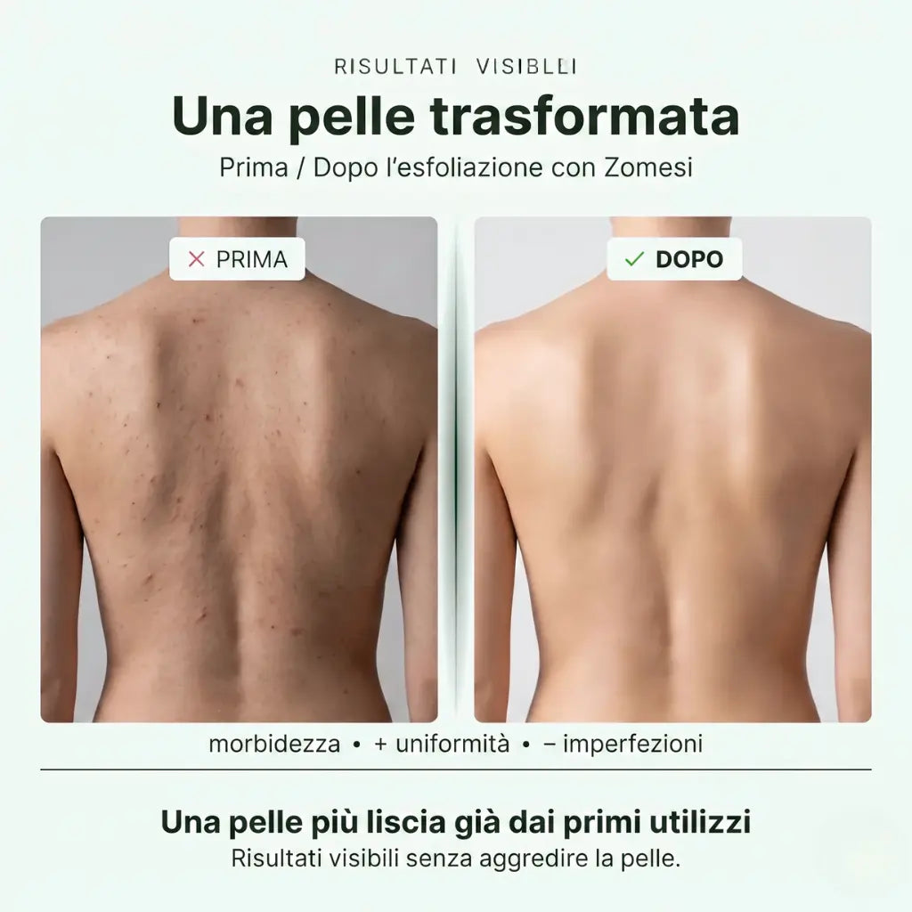 Eskano™ - Asciugamano da doccia esfoliante Zomesi