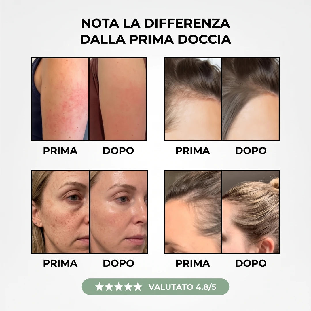 Idrelle™ - Trasforma i tuoi capelli, la tua pelle e la tua doccia